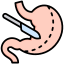 Gastrotomia endoscopica percutanea